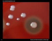 gamma and beta hemolysis